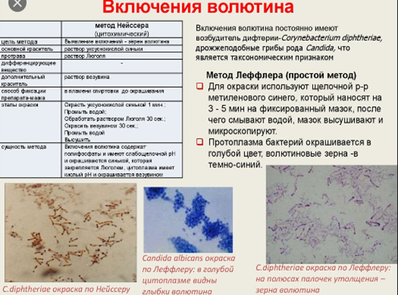 Приготовление по грамму. Окраска включений волютина по методу Леффлера. Методы окрашивания бактерий микробиология. Метод окраски по Нейссеру. Метод окраски зерен волютина.